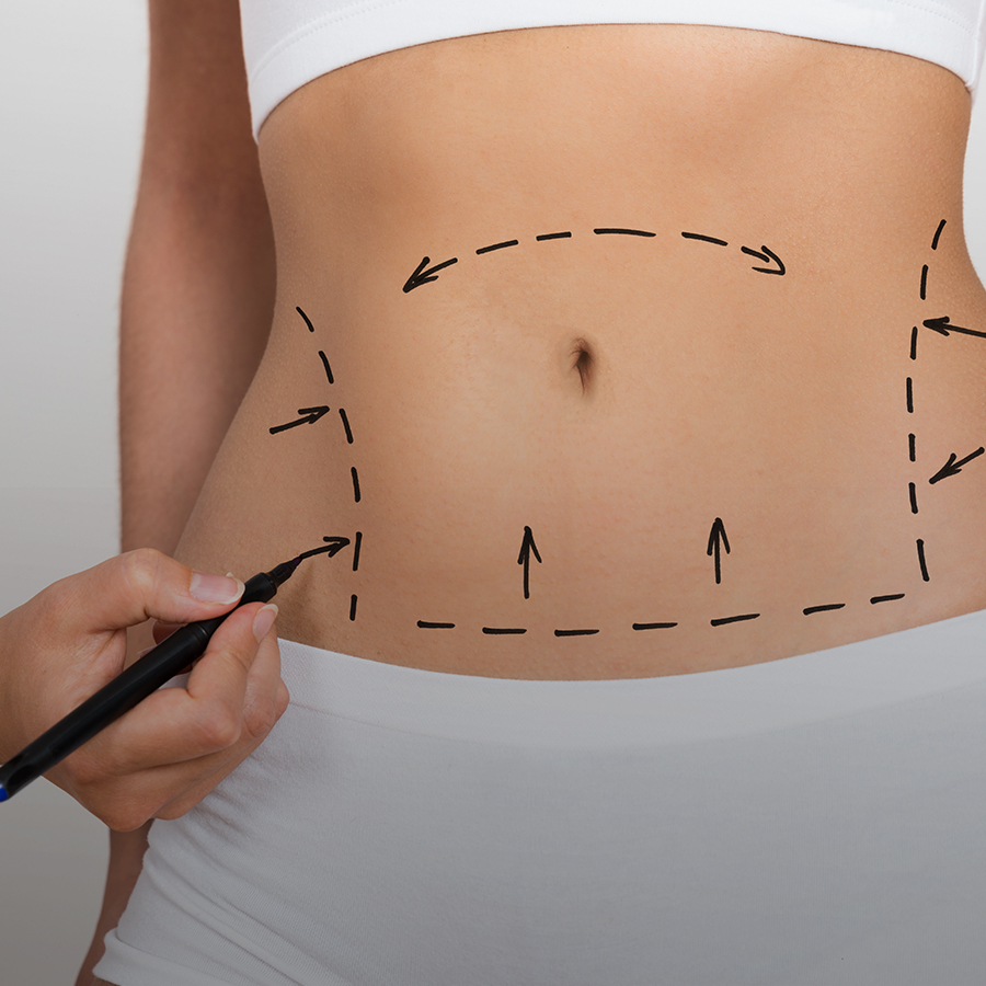 Lipoaspiration HD